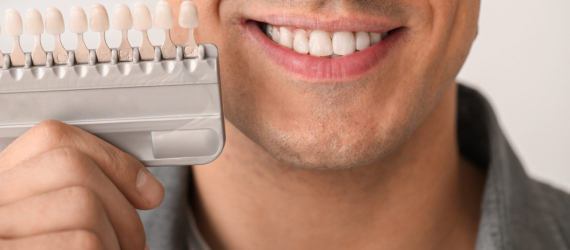 הלבנת שיניים בירושלים